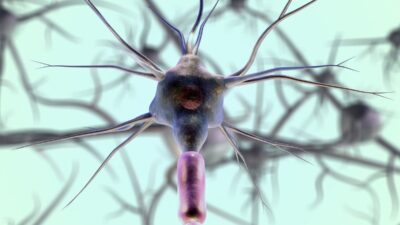 Gangguan Saraf: Memahami Distonia dan Sindrom Tourette